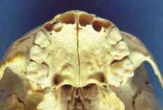 Odontologi­a Forense