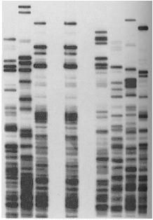 Nociones de identificación forense en la tipificación de DNA